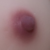 Areola3